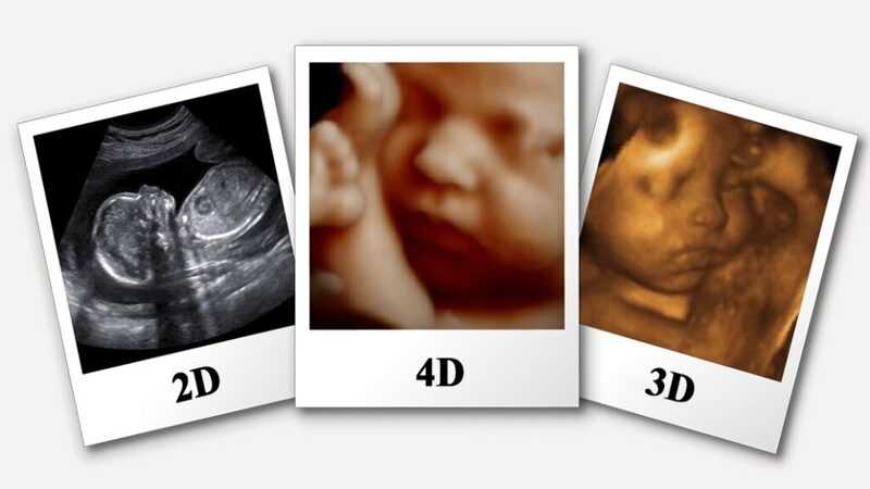 3D & 4D Scan