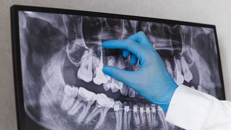 dental-xray